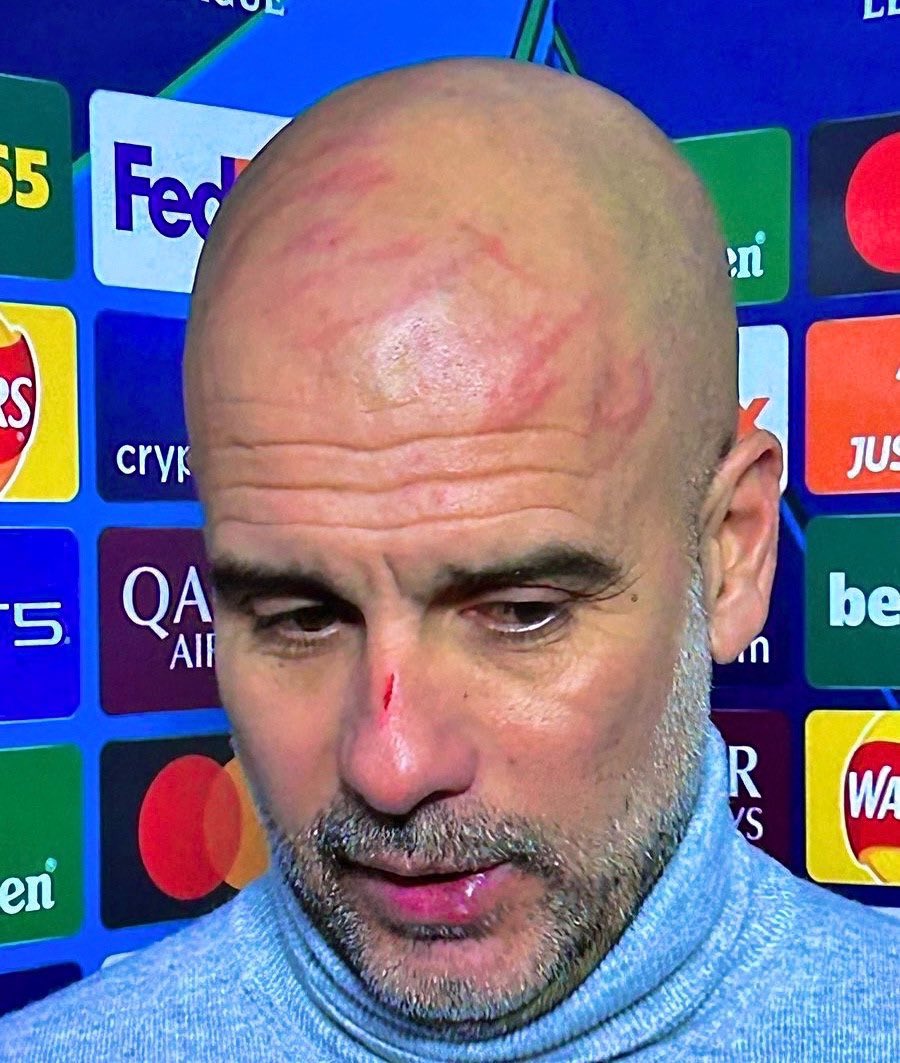 "Nataka kujiumiza!" Guardiola azungumzia mikwaruzo usoni mwake baada ya sare dhidi ya Feyenoord