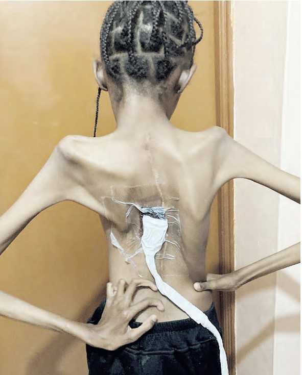 Mother’s plea to save daughter with rare health condition