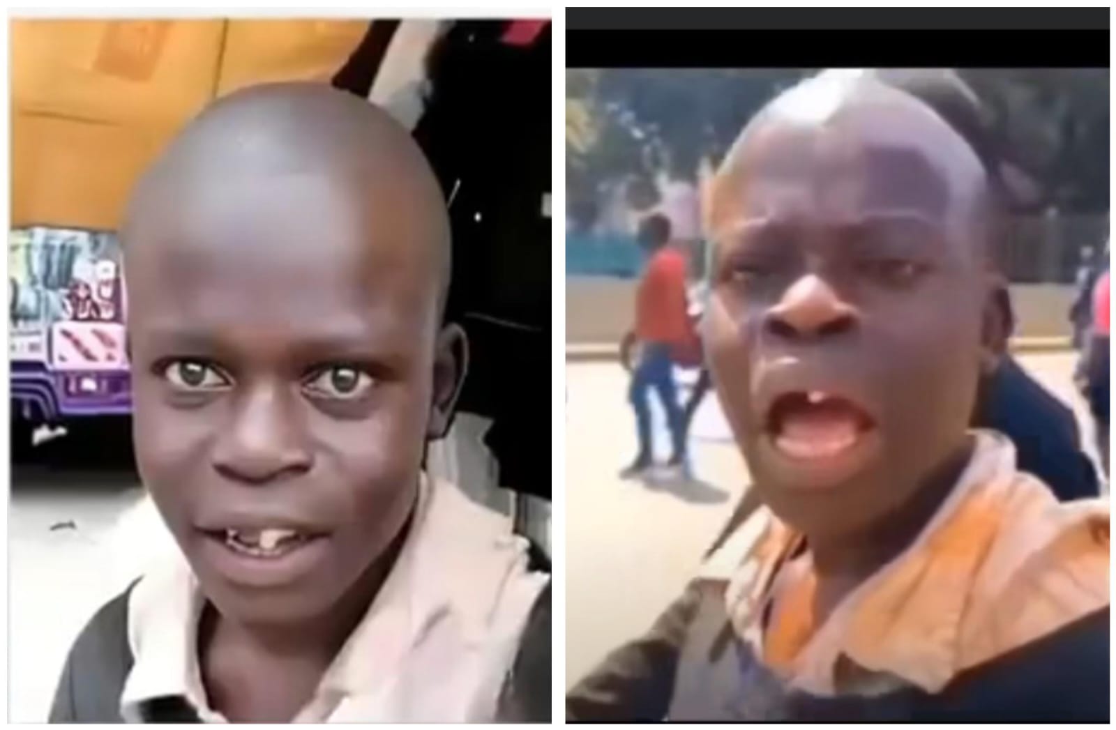 Kijana kwenye video ya "ameuza airport" asimulia alivyopoteza meno ya mbele