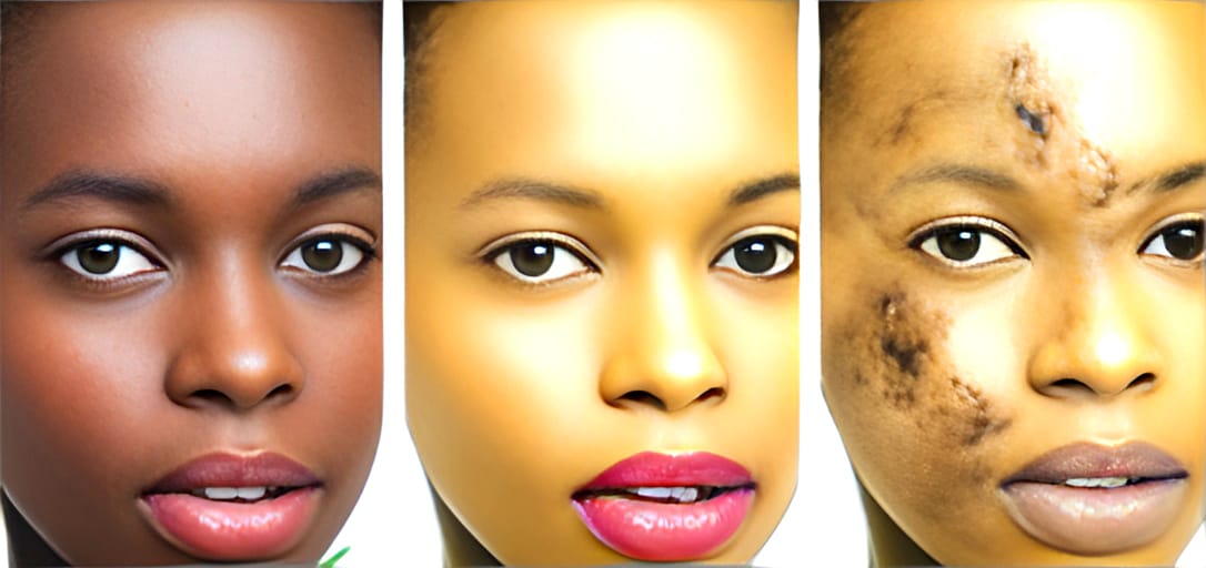 Wanawake wengi zaidi wa Kenya sasa wanapauka ngozi zao