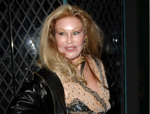 RIP! Mwanamke aliyefanyiwa upasuaji ili kufanana na paka afariki