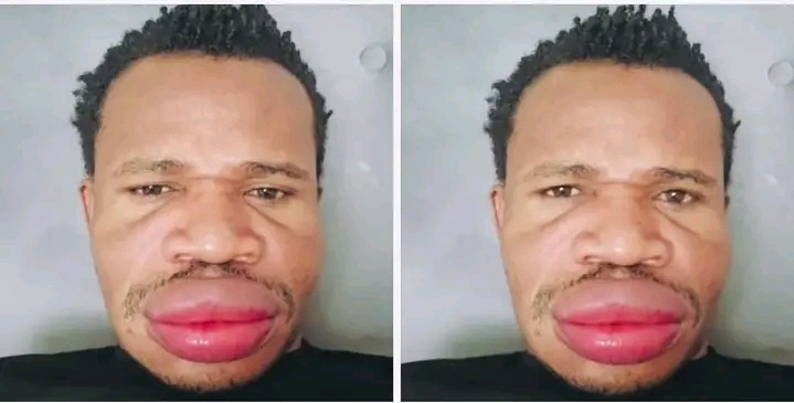 Muonekano Mpya Wa Salasya Baada Ya Kudai Kufanya Upasuaji Wa Midomo (Video)