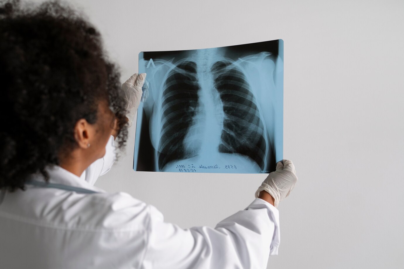 EXPLAINER: What you need to know about pulmonary oedema