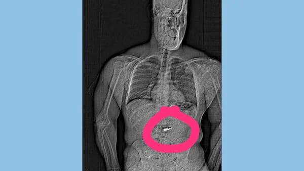 Mshangao huku mwizi akimeza hereni za almasi za milioni 99 ili kuficha ushahidi