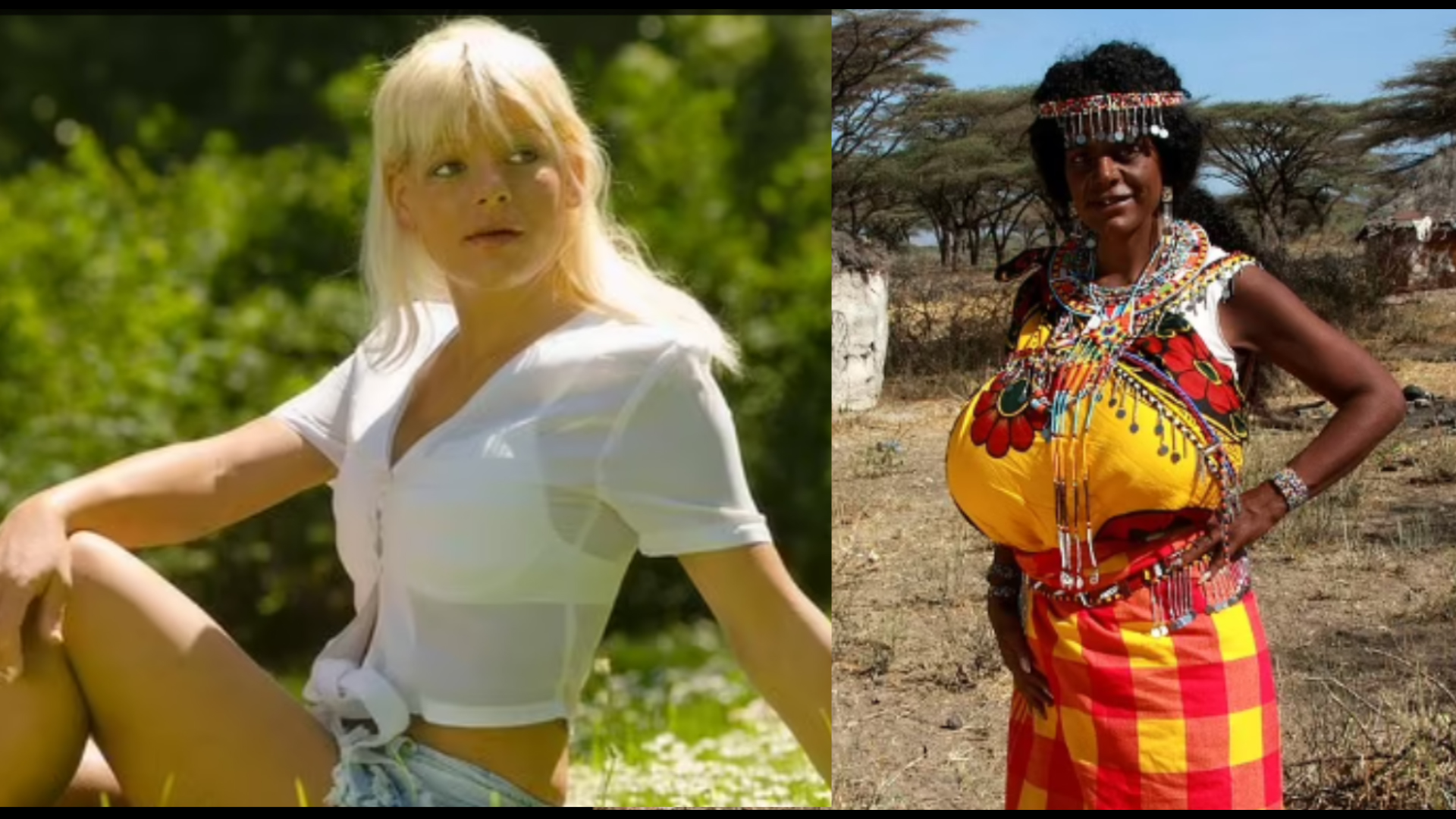 Mzungu aliyedungwa sindano ya kugeuza rangi ya ngozi kuwa nyeusi atetea hatua yake