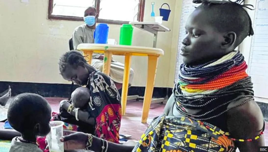 Starvation alert as children fill Kenya refugee ward after US aid cuts
