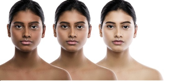 Opinion: Is Skin Bleaching Really Worth It?