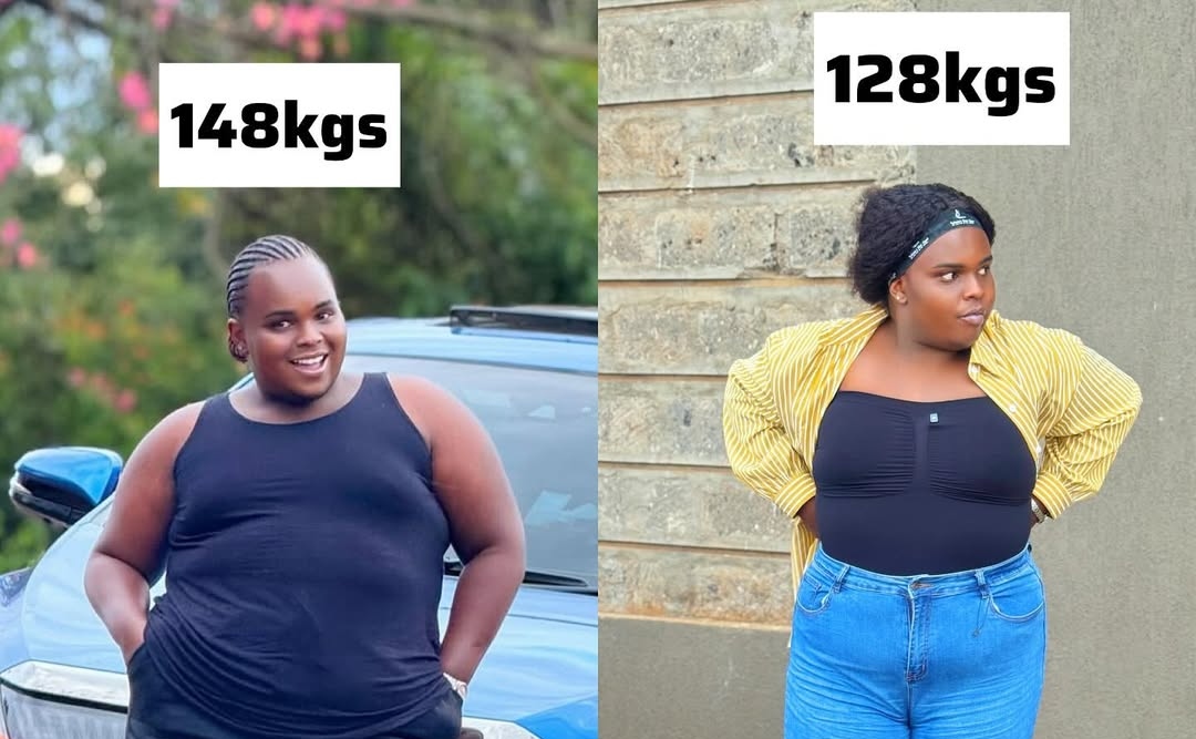 The Real Cost of Getting Slim in Kenya: A Look at the Options