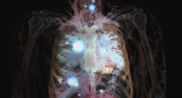 Promising cancer treatments trigger serious side effects - research
