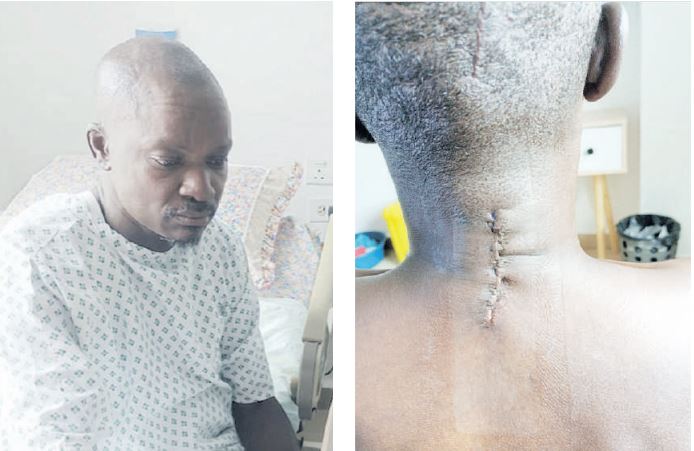 Makori: Surgery has nothing on me, I will soon jog again