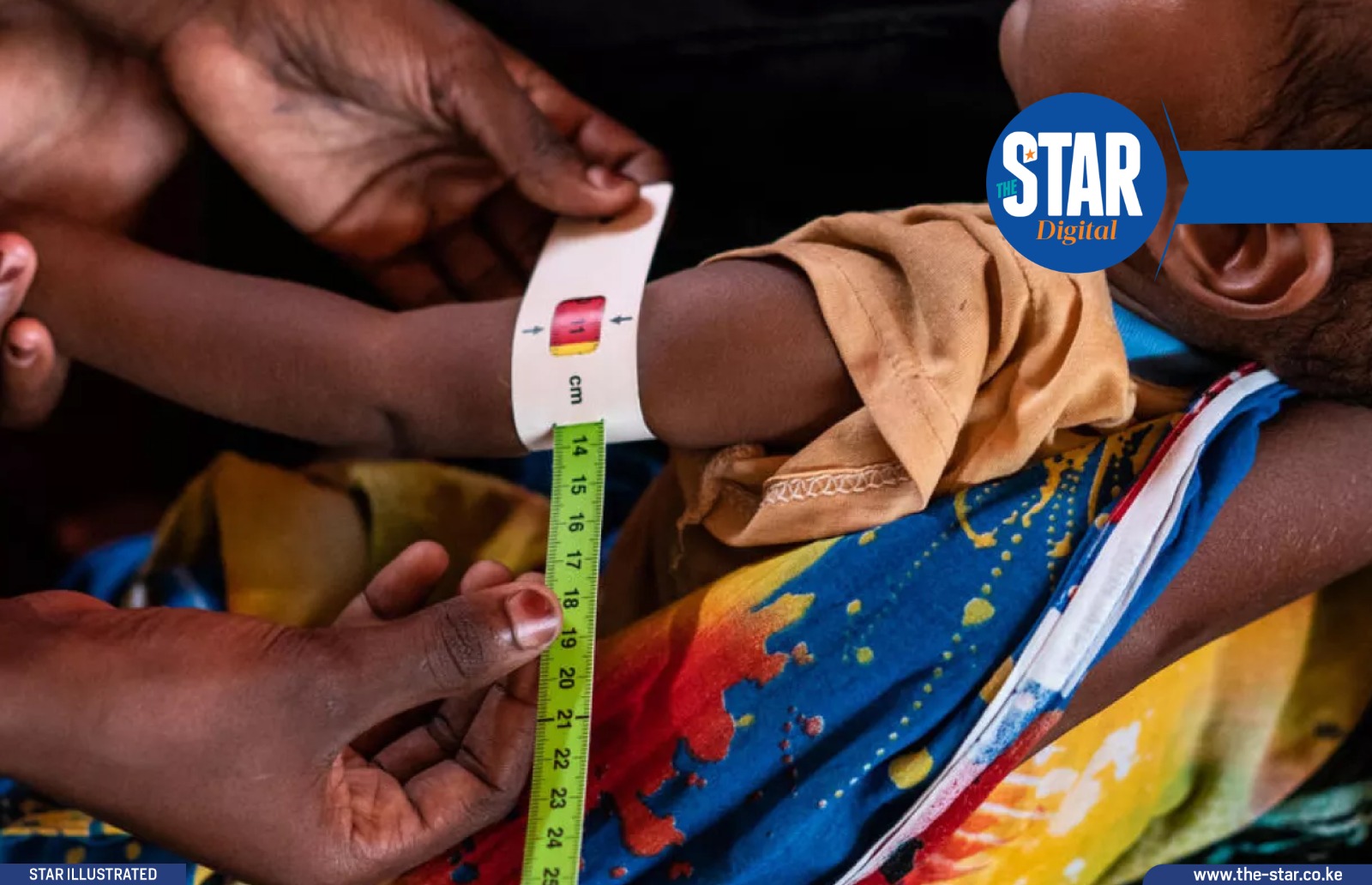 Prevalence of stunting in Kenya: Top and Bottom 5 counties