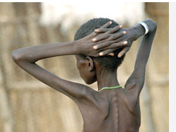 Triple burden: Battle with malnutrition slows Kenya’s gains