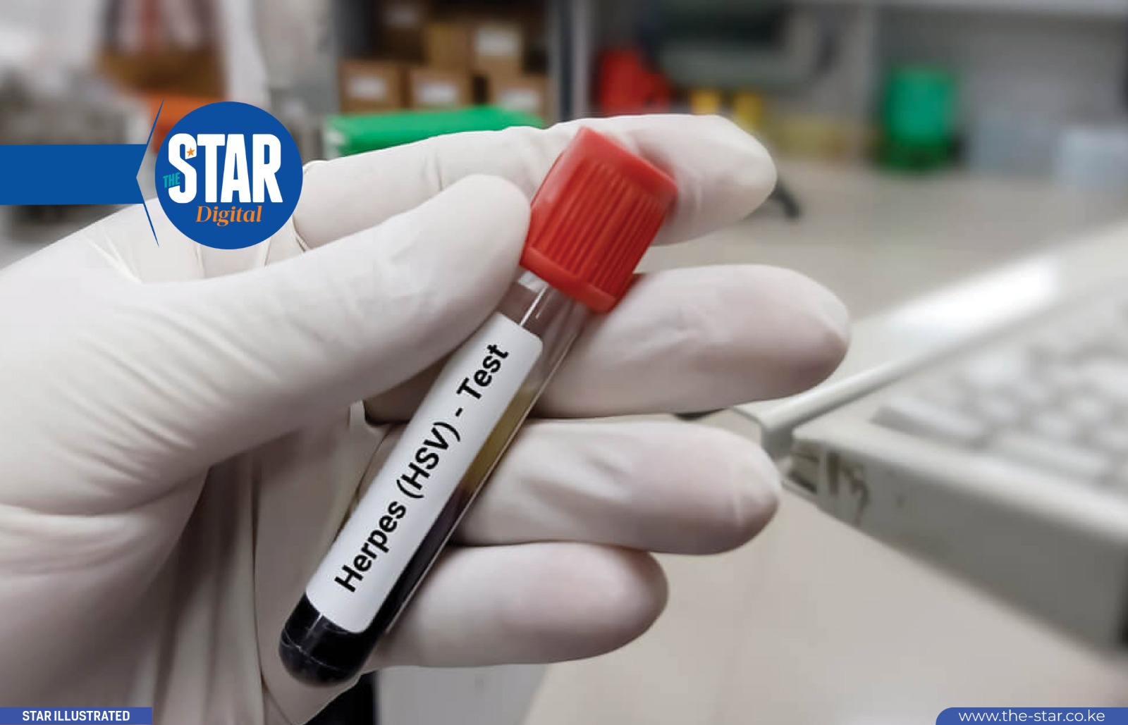 Men vs Women: Who is more prone to Sexually Transmitted Infections?