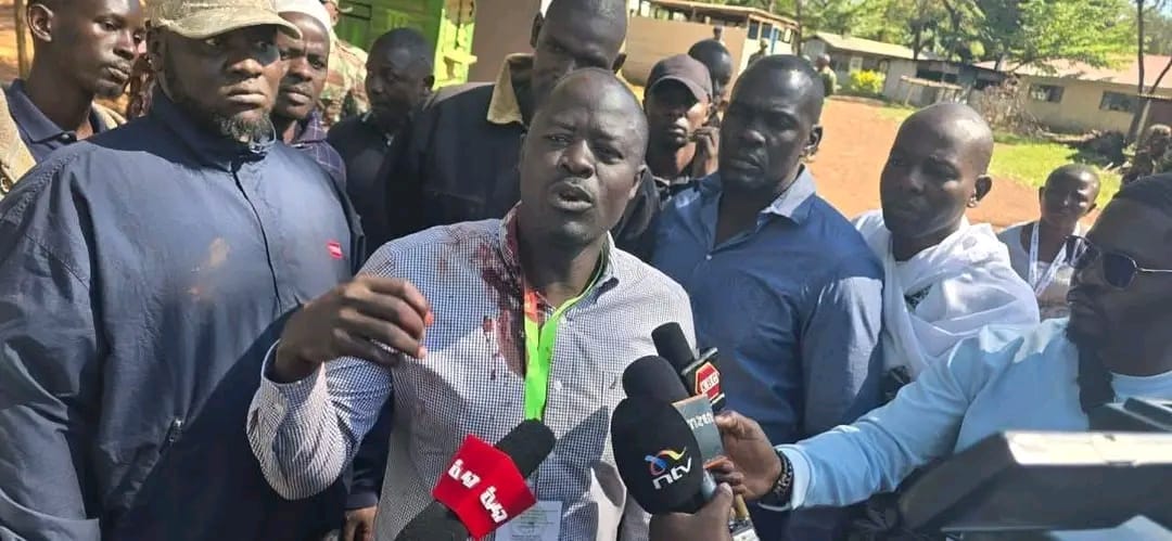 Kaluma, bodyguard attacked, firearm reportedly stolen