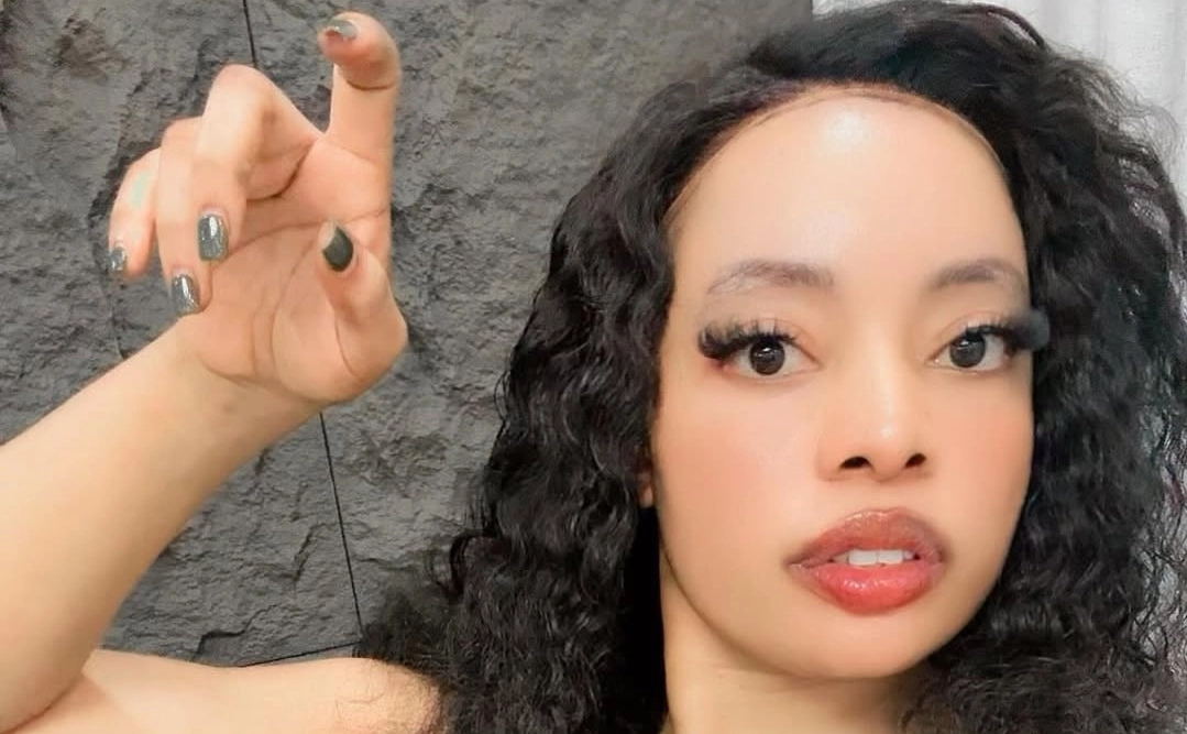 Gloria Ntazola’s Cosmetic Journey of Tummy Tuck & Lip Fillers