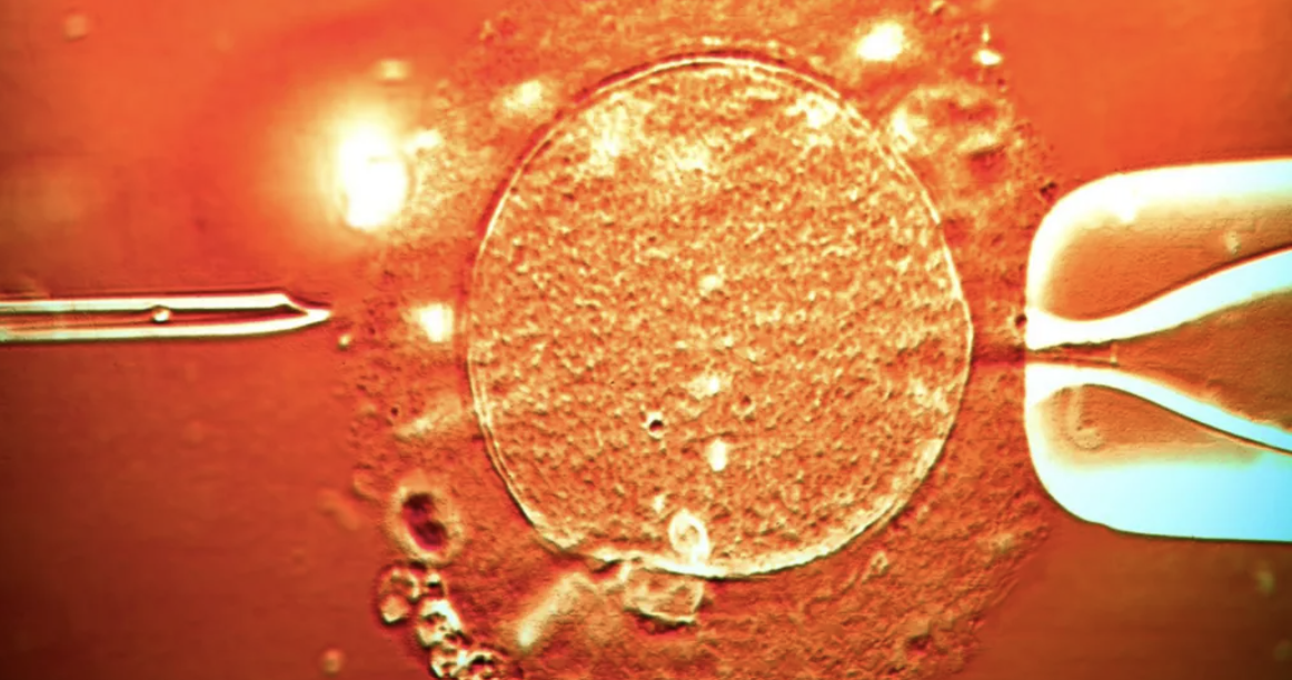 Sperm from donor with cancer-causing gene used to conceive 200 children
