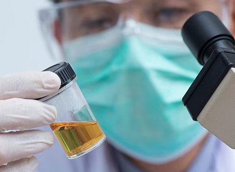 How urine test could predict life expectancy