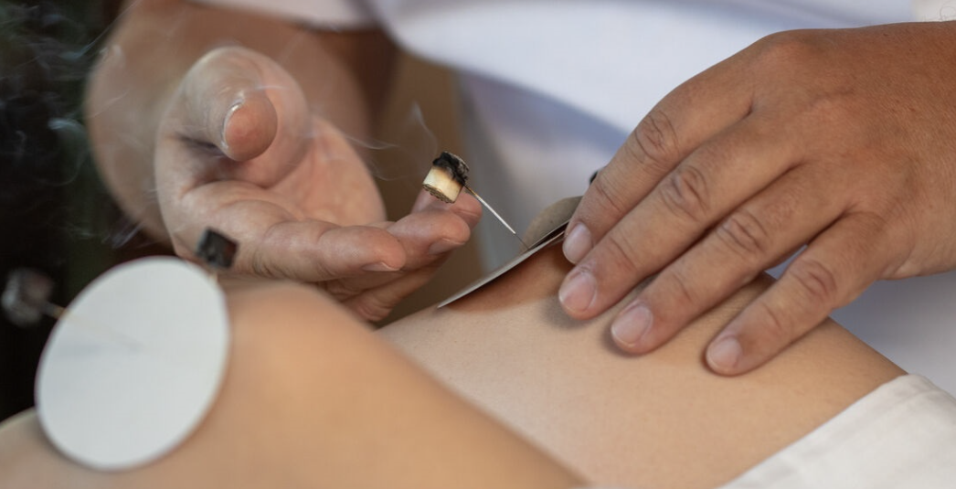 WHO summit sets global agenda for traditional medicine