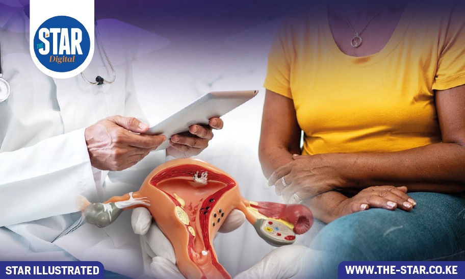 The burden of Cervical Cancer in Kenya