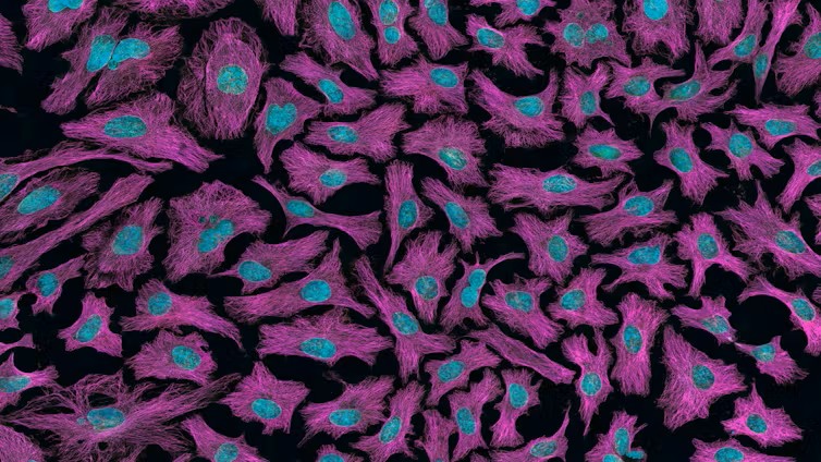 What’s the difference between a tumour and cancer?