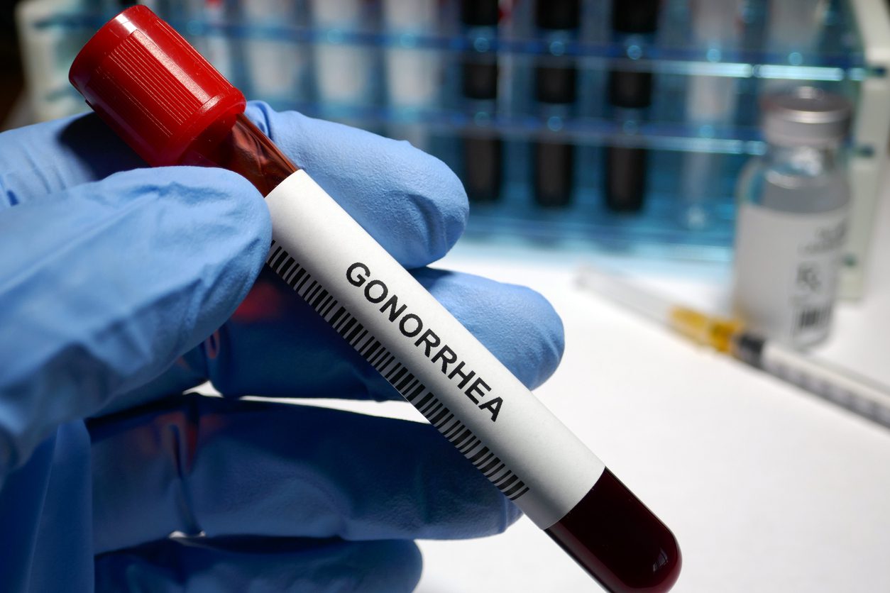 Kisumu tops counties with drug-resistant gonorrhea