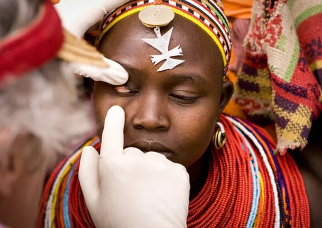 Kenya’s journey toward trachoma elimination