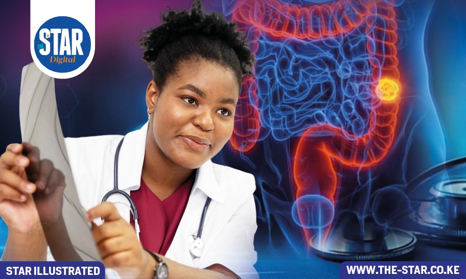 Colorectal Cancer: What you should know