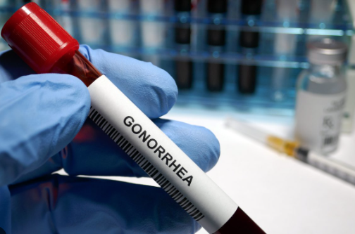 Experts: Be wary, gonorrhea is outsmarting antibiotics