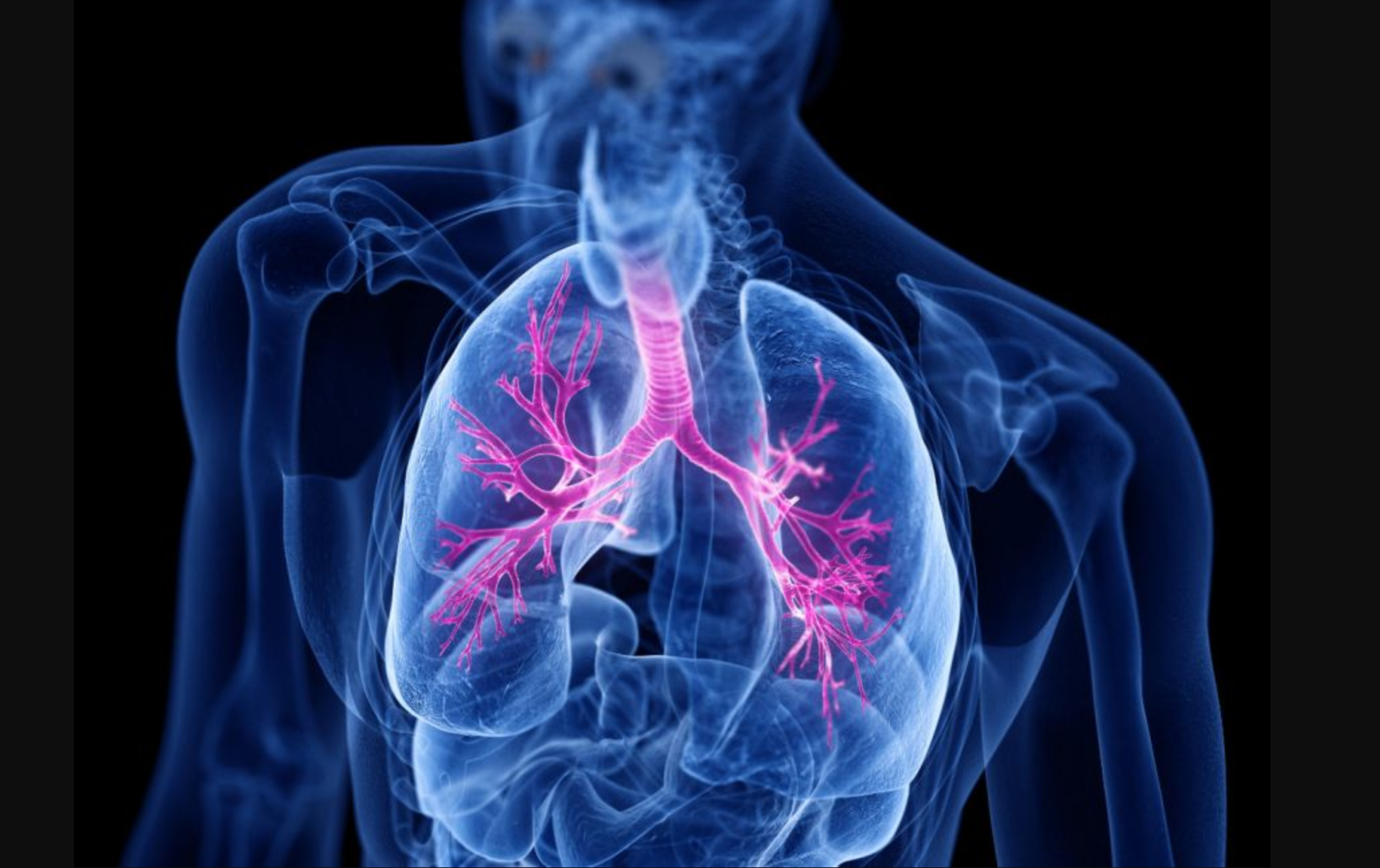 Non-TB lung patients left behind in Kenya - MoH