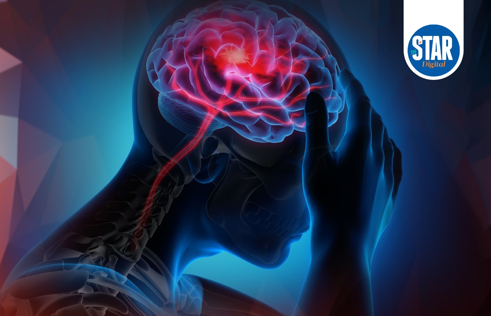 What to know about stroke