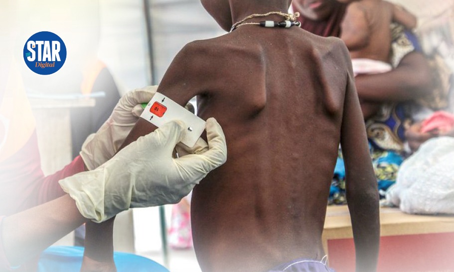 Malnutrition worsens in 7 counties, NDMA warns