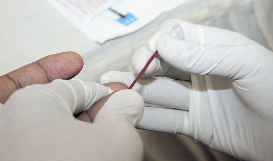 HIV testing