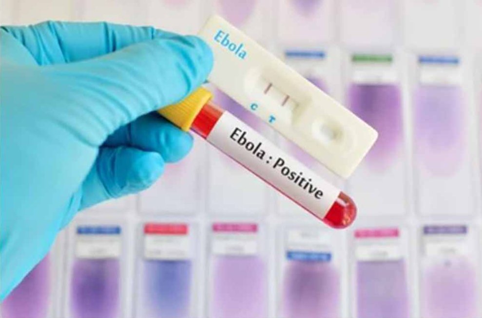 Men Recovering from Ebola Advised to Avoid Intimacy for 6 Months