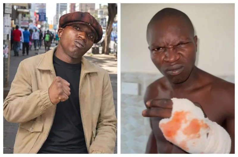 Mbavu Destroyer: 'Two of My Fingers Were Bitten'