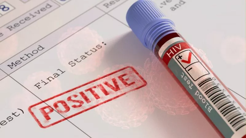 Facing HIV Stigma: Why Rejection Hurts More Than Managing the Virus