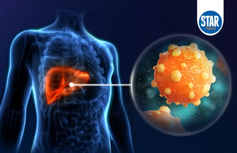 Preventable but deadly: Global Burden of Hepatitis B