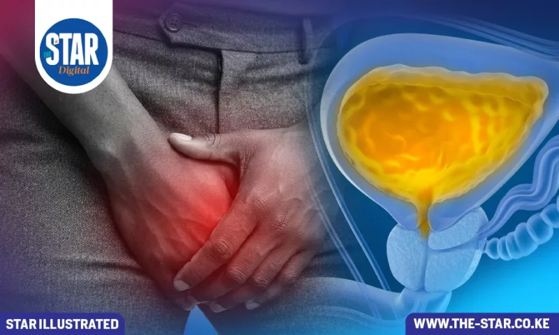 What to know about an overactive bladder