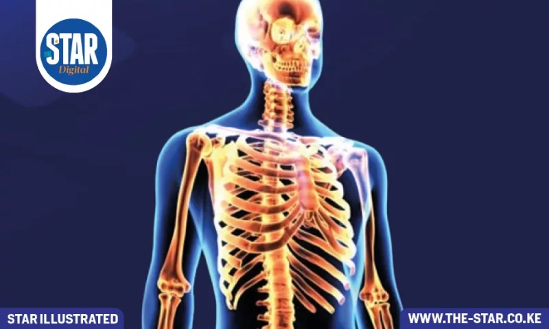 Global number of most commonly broken bones