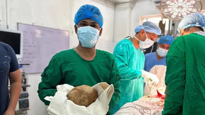 Doctors remove 3.1kg stone from man's bladder