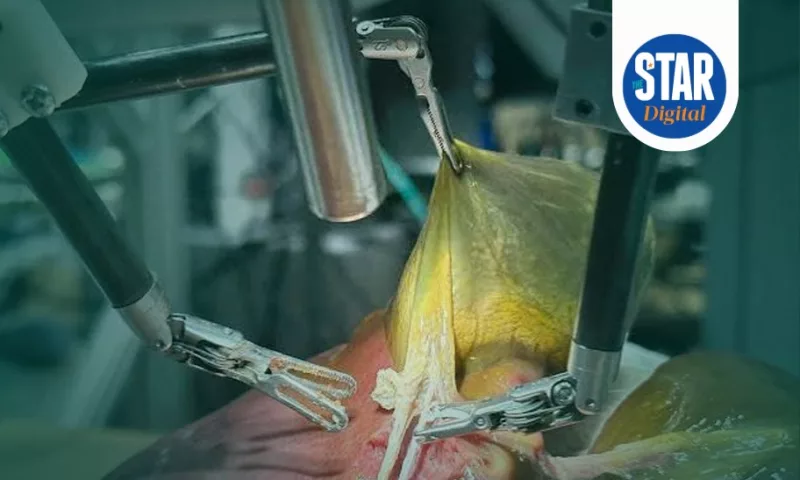 Robotic gallbladder surgery: What you need to know