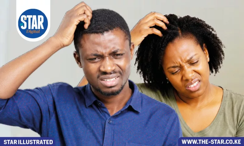 Itchy scalp treatment: options to consider