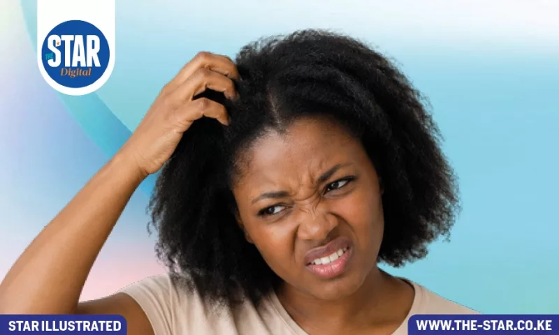 What can cause an itchy scalp?