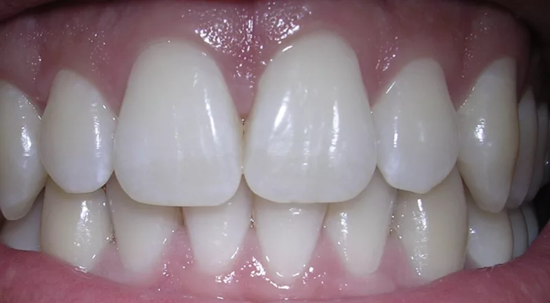TEETH