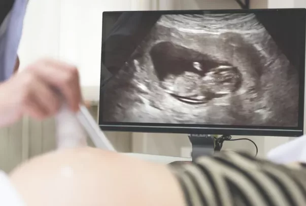 Head of maternity review says 'we will listen to parents'